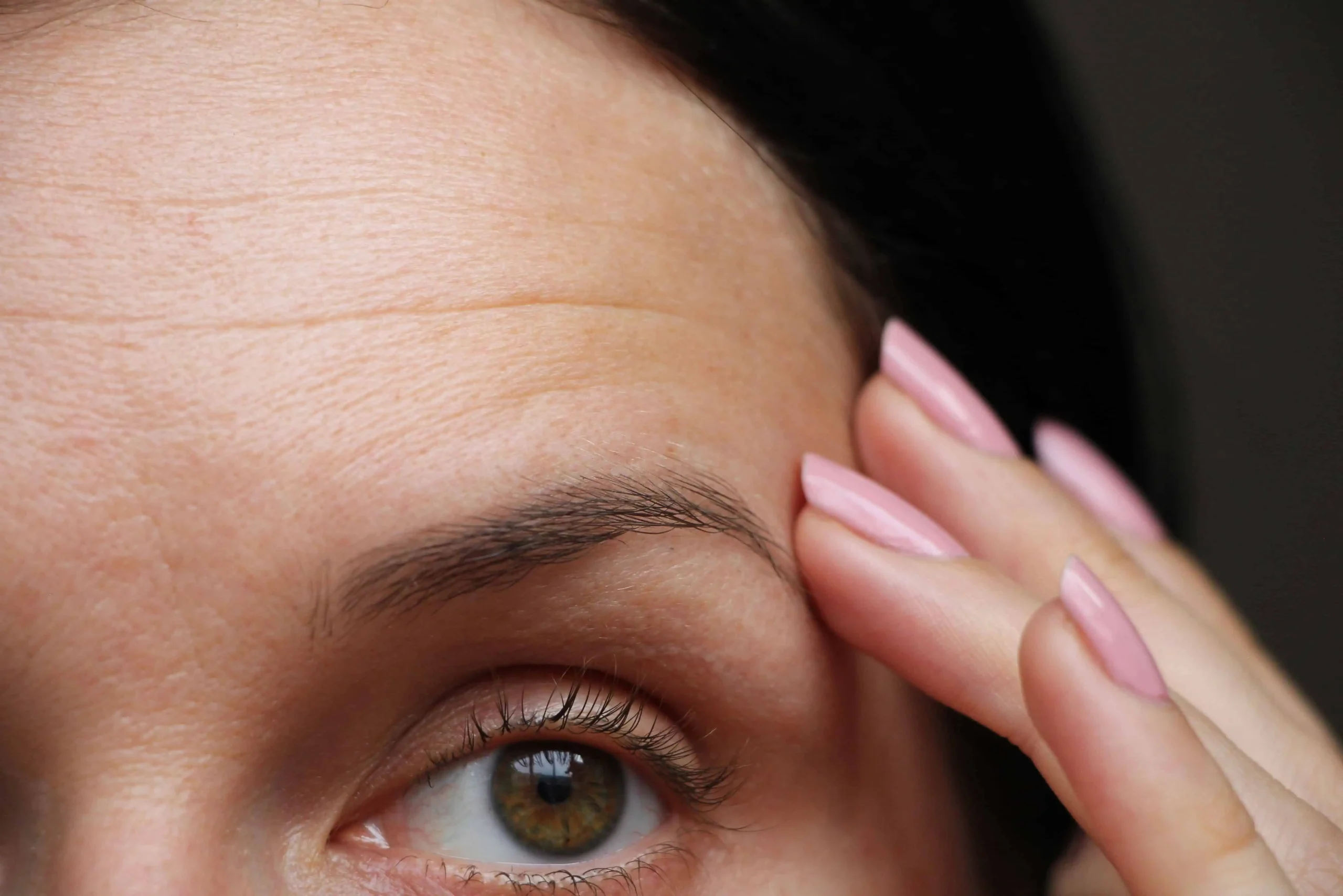 Dysport for Forehead Lines Results and Benefits