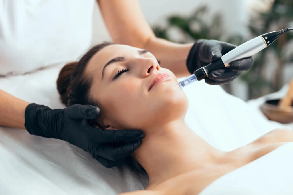 Microneedling in Superior, CO By Tru Balanced Medical Aesthetics