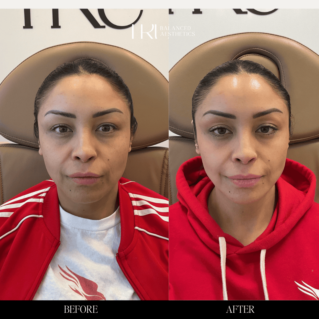 Copy of Before and Afters - 3 (1)