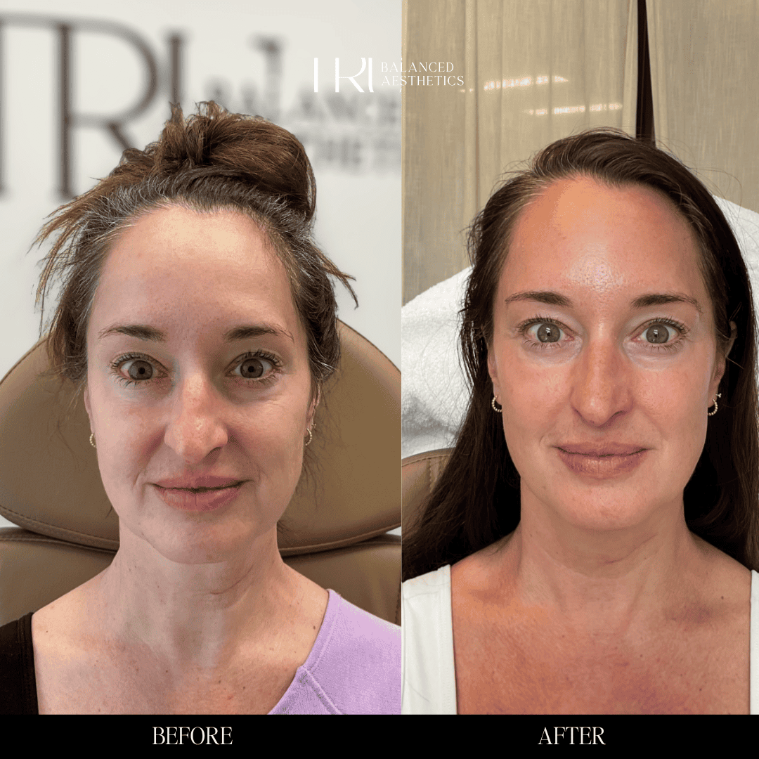 Copy of Before and Afters - 3 (2)