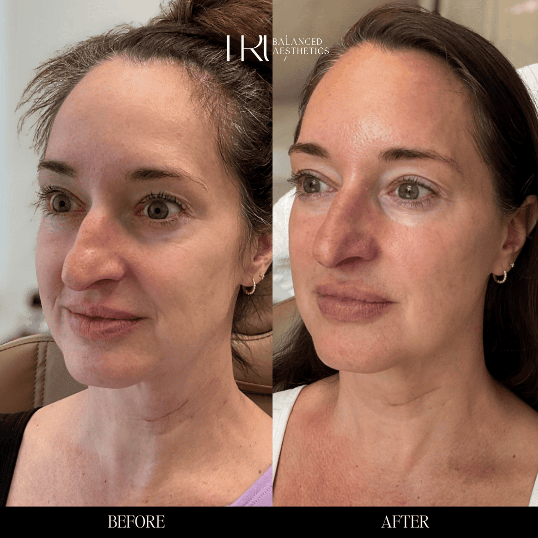 Copy of Before and Afters - 3 (3)