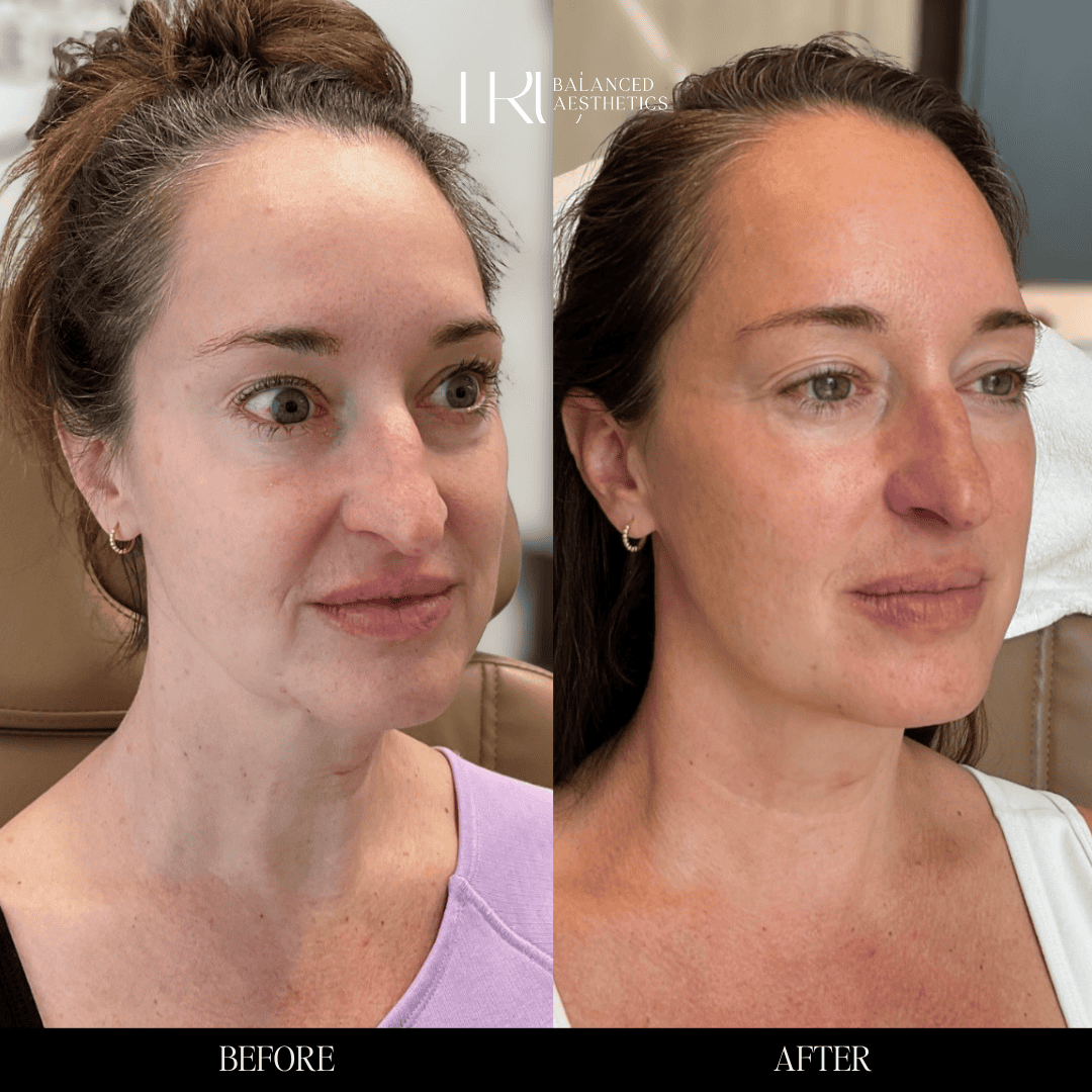 Copy of Before and Afters - 3 (4)