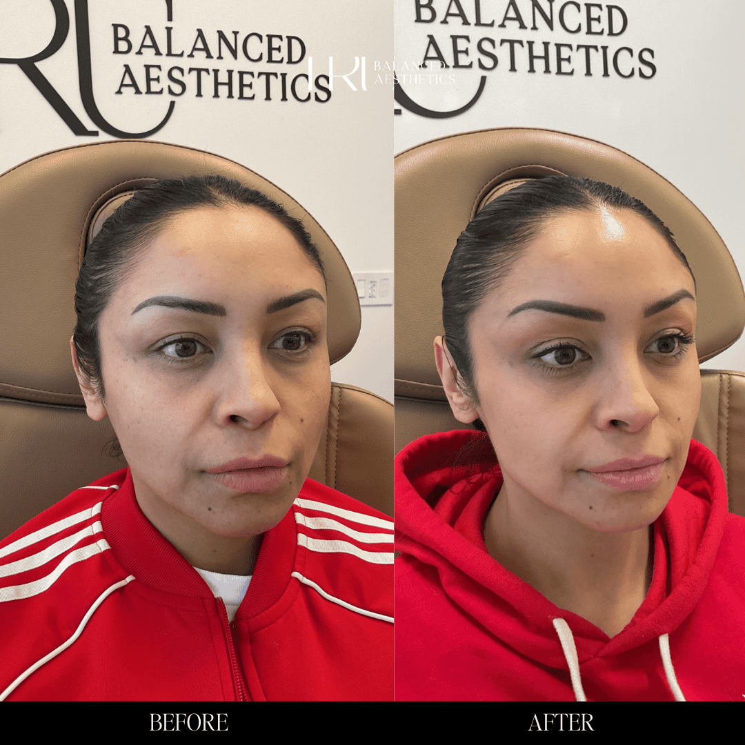 Copy of Before and Afters - 3