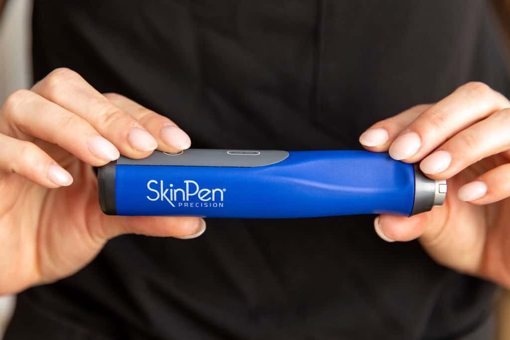 microneedling